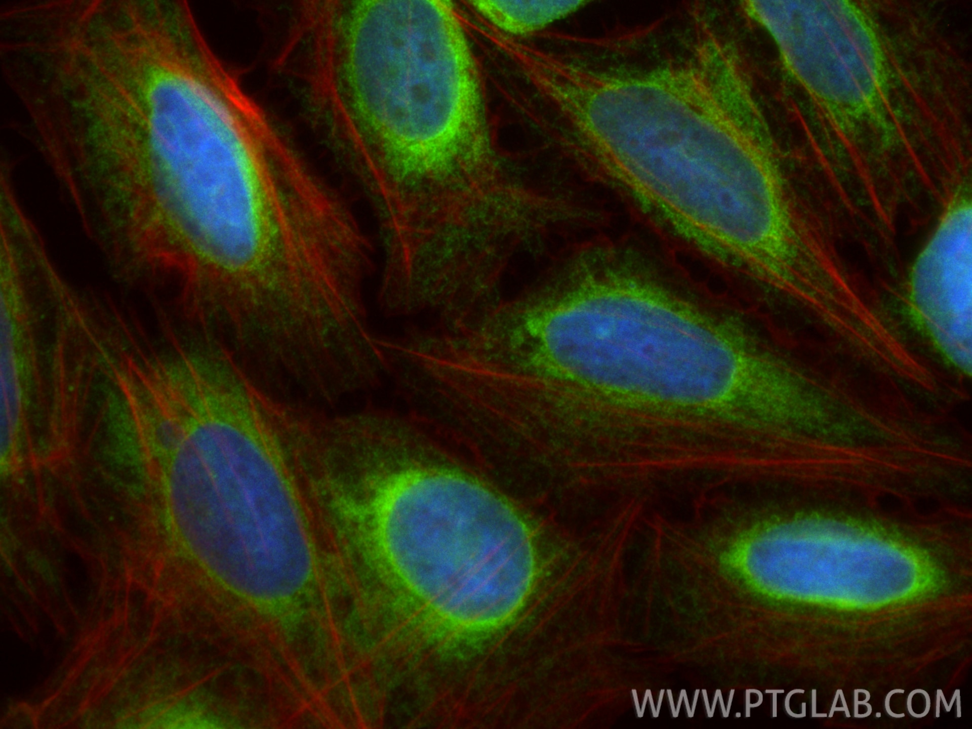 IF Staining of U2OS using 11334-1-AP Immunofluorescence (IF) / fluorescent staining of U2OS cells using PTPN1/PTP1B Polyclonal antibody (11334-1-AP)