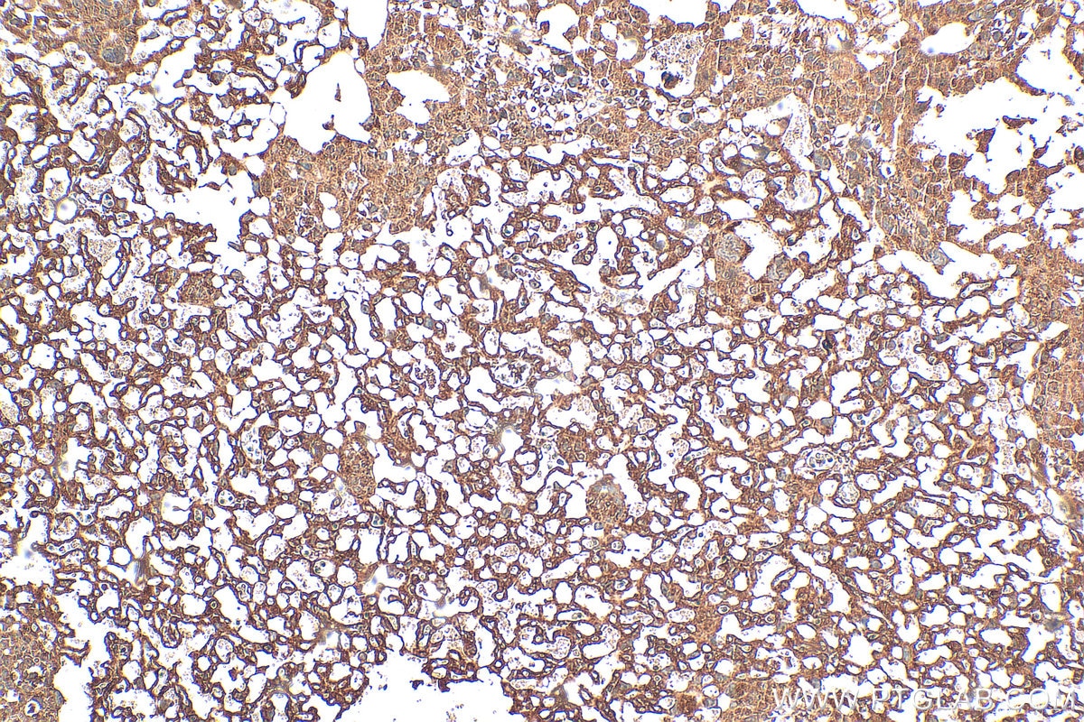 Immunohistochemistry (IHC) staining of mouse placenta tissue using PTPN1/PTP1B Polyclonal antibody (11334-1-AP)