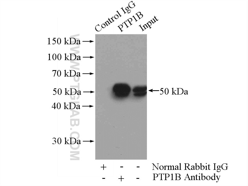 IP experiment of A431 using 11334-1-AP