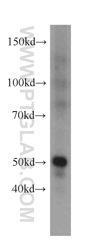 Western Blot (WB) analysis of human testis tissue using PTP1B Polyclonal antibody (11334-1-AP)