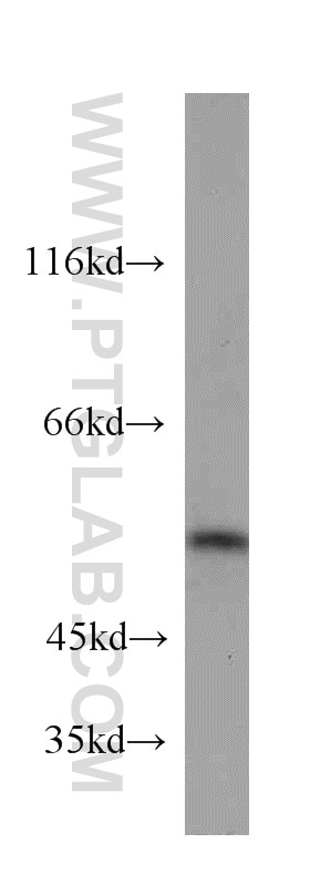 Western Blot (WB) analysis of human placenta tissue using PTP1B Polyclonal antibody (11334-1-AP)
