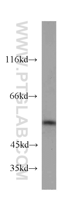 Western Blot (WB) analysis of human placenta tissue using PTP1B Polyclonal antibody (11334-1-AP)