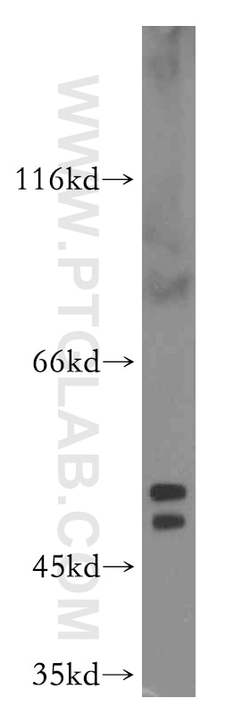 Western Blot (WB) analysis of BxPC-3 cells using PTP1B Polyclonal antibody (11334-1-AP)