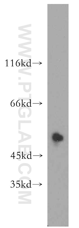 Western Blot (WB) analysis of A431 cells using PTP1B Polyclonal antibody (11334-1-AP)