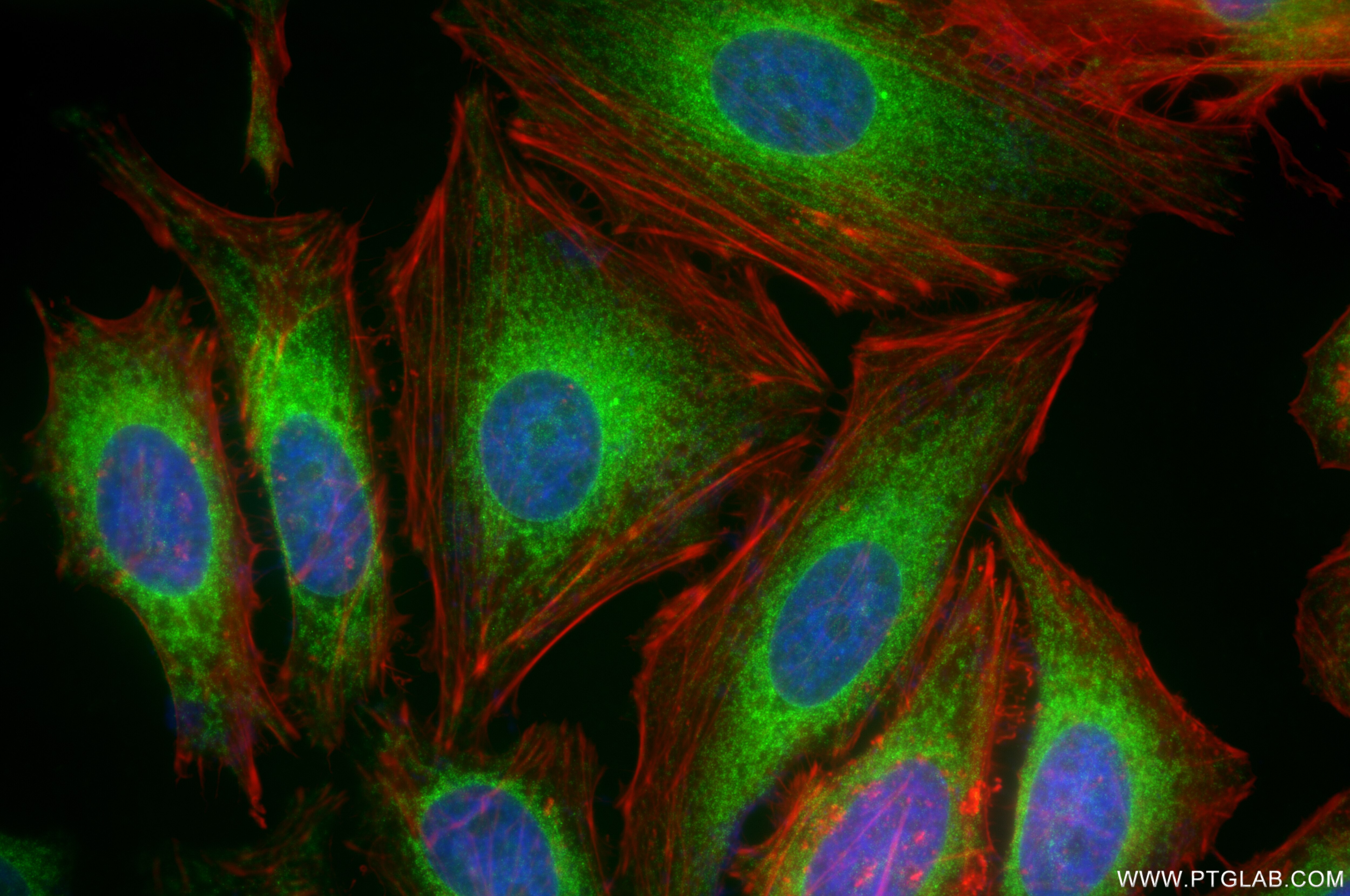Immunofluorescence (IF) / fluorescent staining of HeLa cells using PTPN1/PTP1B Recombinant antibody (85905-4-RR)