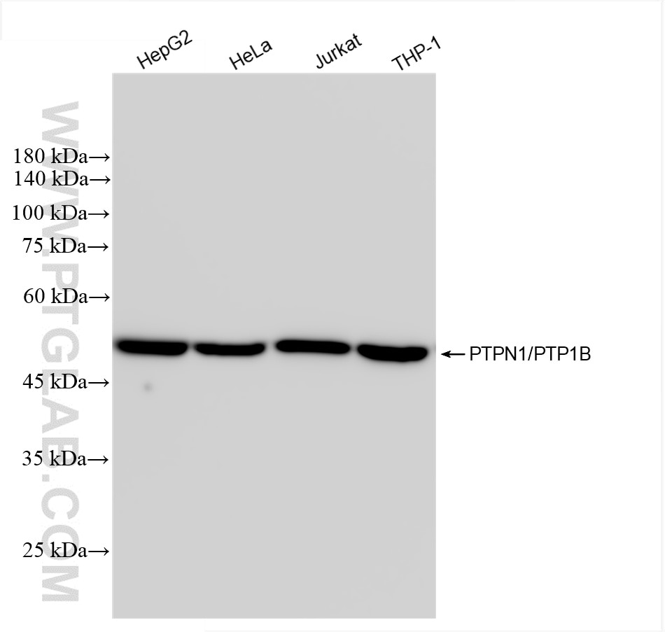 PTPN1/PTP1B