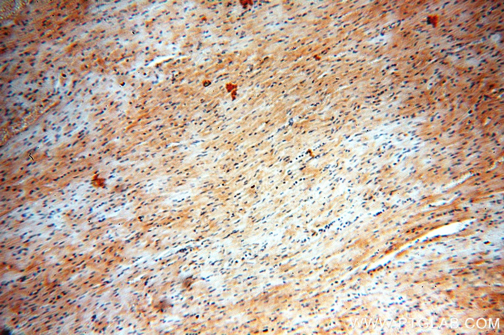 Immunohistochemistry (IHC) staining of human heart tissue using PTPN11/SHP2 Polyclonal antibody (20145-1-AP)