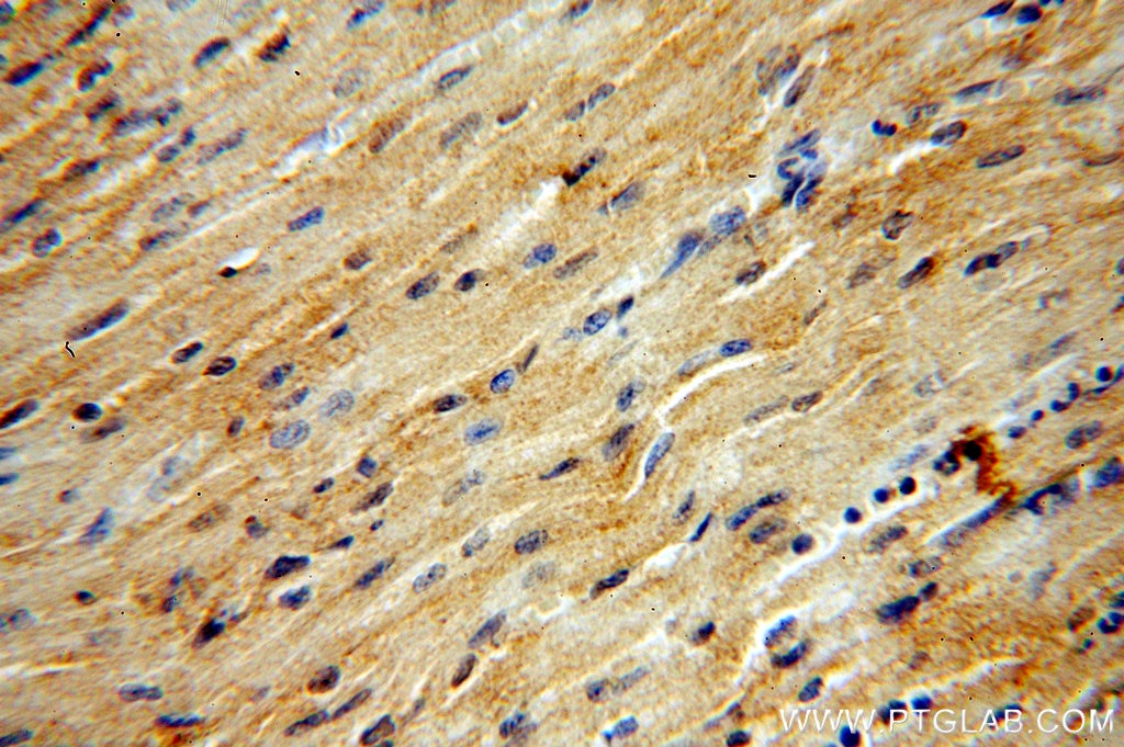 IHC staining of human heart using 20145-1-AP