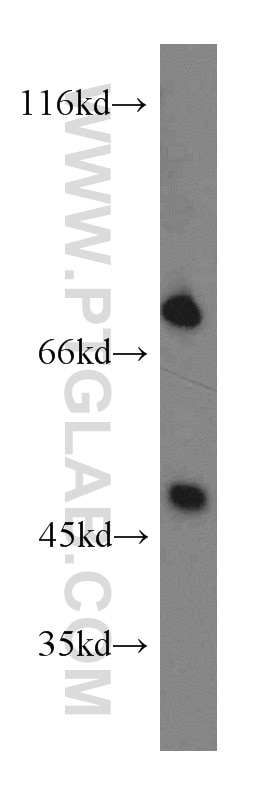 Western Blot (WB) analysis of Jurkat cells using PTPN11/SHP2 Polyclonal antibody (20145-1-AP)