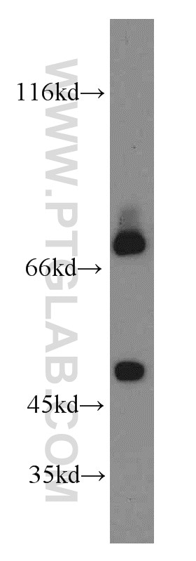 Western Blot (WB) analysis of MCF-7 cells using SHP2 Polyclonal antibody (20145-1-AP)
