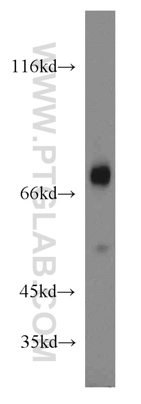 Western Blot (WB) analysis of human heart tissue using SHP2 Polyclonal antibody (20145-1-AP)