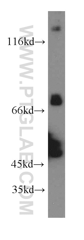 Western Blot (WB) analysis of human brain tissue using PTPN11/SHP2 Polyclonal antibody (20145-1-AP)