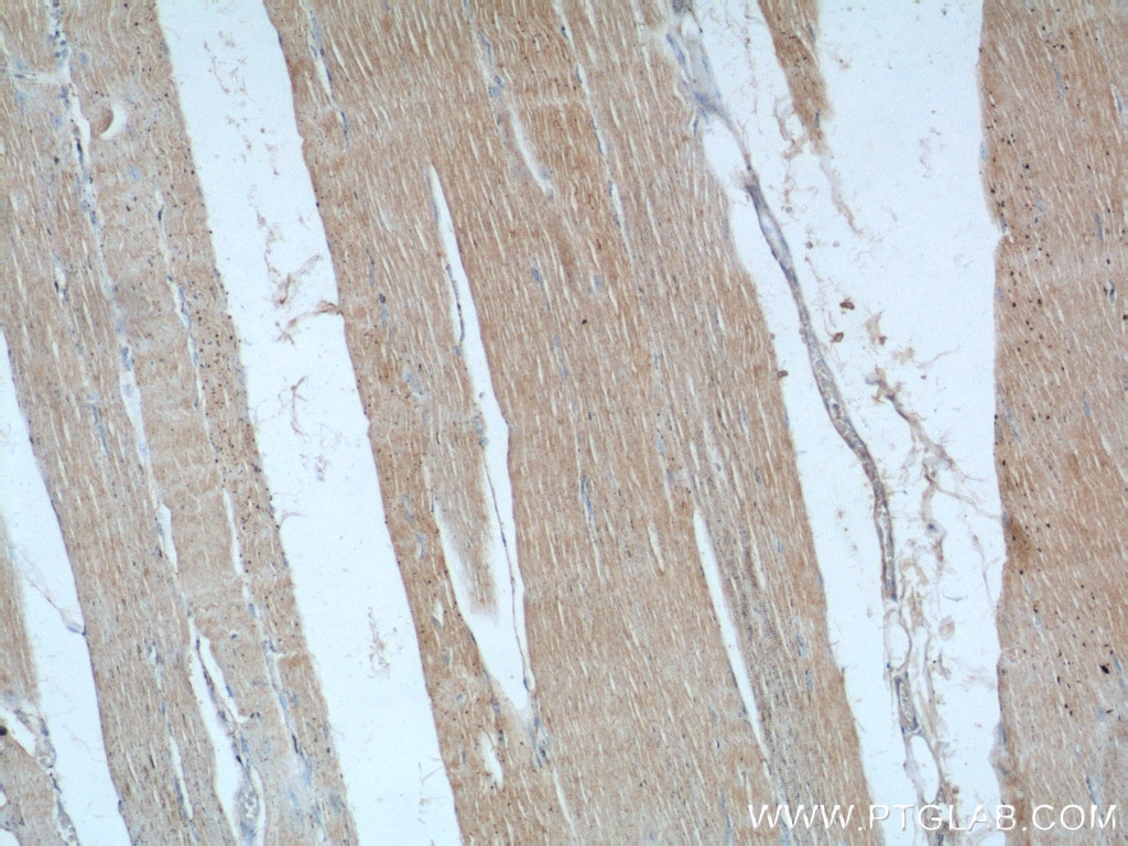Immunohistochemistry (IHC) staining of human skeletal muscle tissue using PTPN11 Polyclonal antibody (24570-1-AP)