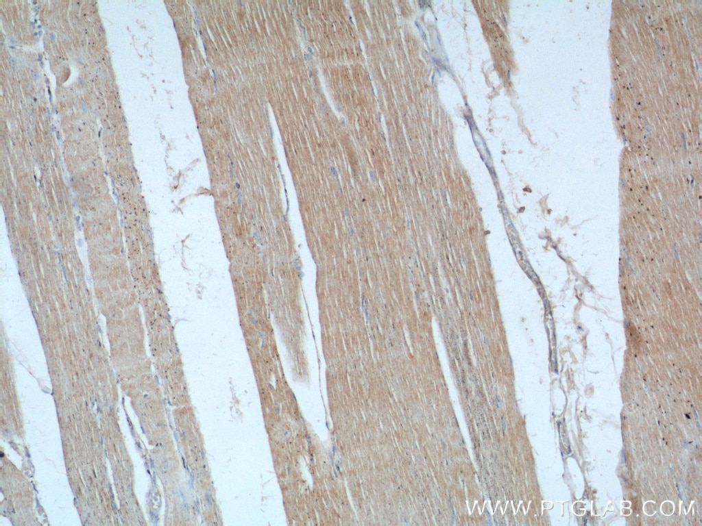 Immunohistochemistry (IHC) staining of human skeletal muscle tissue using PTPN11/SHP2 Polyclonal antibody (24570-1-AP)