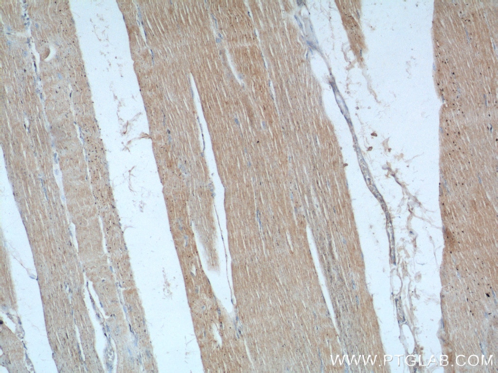 IHC staining of human skeletal muscle using 24570-1-AP