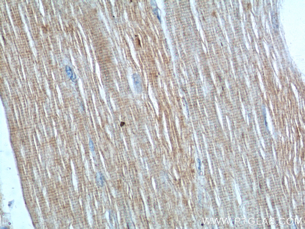 IHC staining of human skeletal muscle using 24570-1-AP