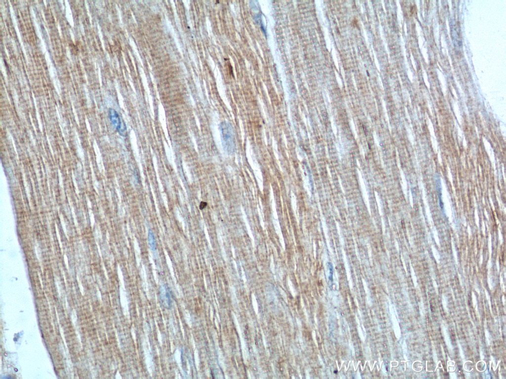 Immunohistochemistry (IHC) staining of human skeletal muscle tissue using PTPN11/SHP2 Polyclonal antibody (24570-1-AP)