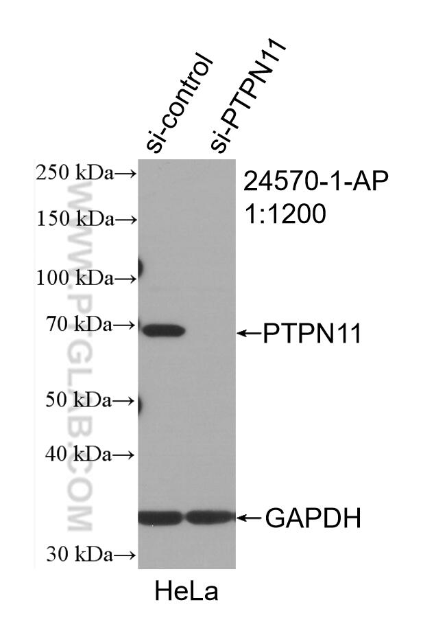 Western Blot (WB) analysis of HeLa cells using PTPN11 Polyclonal antibody (24570-1-AP)