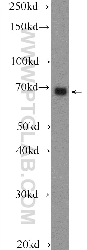Western Blot (WB) analysis of MCF-7 cells using PTPN11 Polyclonal antibody (24570-1-AP)