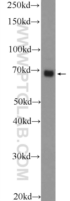 Western Blot (WB) analysis of MCF-7 cells using PTPN11/SHP2 Polyclonal antibody (24570-1-AP)