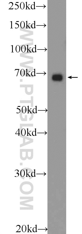 Western Blot (WB) analysis of HEK-293 cells using PTPN11/SHP2 Polyclonal antibody (24570-1-AP)