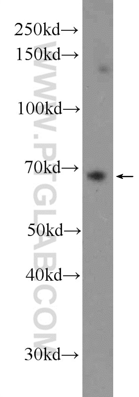 Western Blot (WB) analysis of U-937 cells using PTPN11/SHP2 Polyclonal antibody (24570-1-AP)