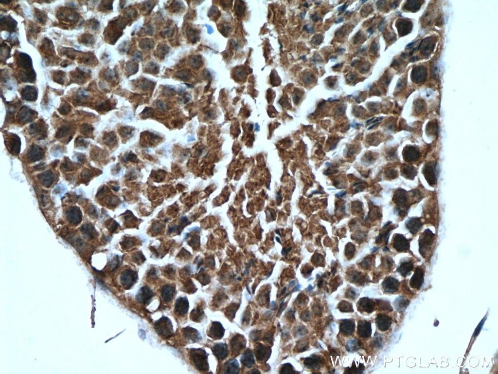 Immunohistochemistry (IHC) staining of mouse testis tissue using SHP2 Monoclonal antibody (66795-1-Ig)