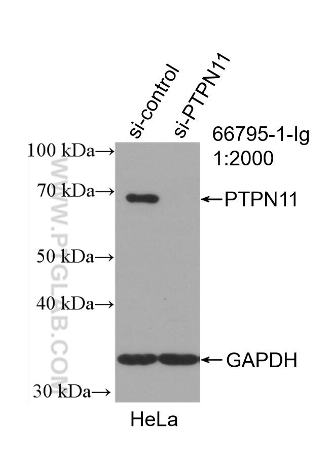 Western Blot (WB) analysis of HeLa cells using PTPN11/SHP2 Monoclonal antibody (66795-1-Ig)