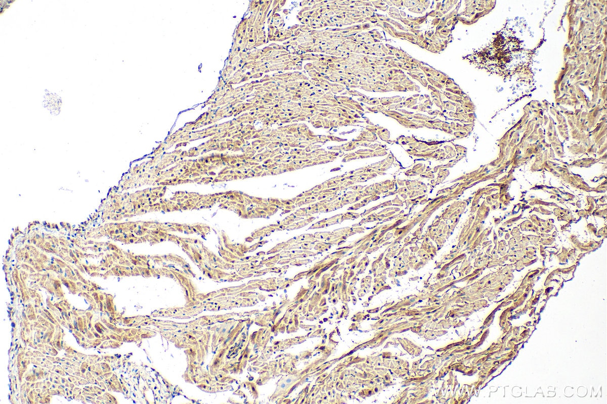 Immunohistochemistry (IHC) staining of rat heart tissue using PTPN11/SHP2 Recombinant antibody (82503-1-RR)