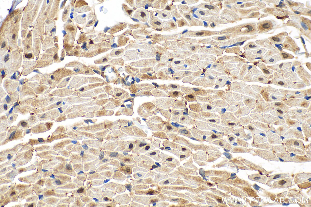 Immunohistochemistry (IHC) staining of rat heart tissue using PTPN11/SHP2 Recombinant antibody (82503-1-RR)