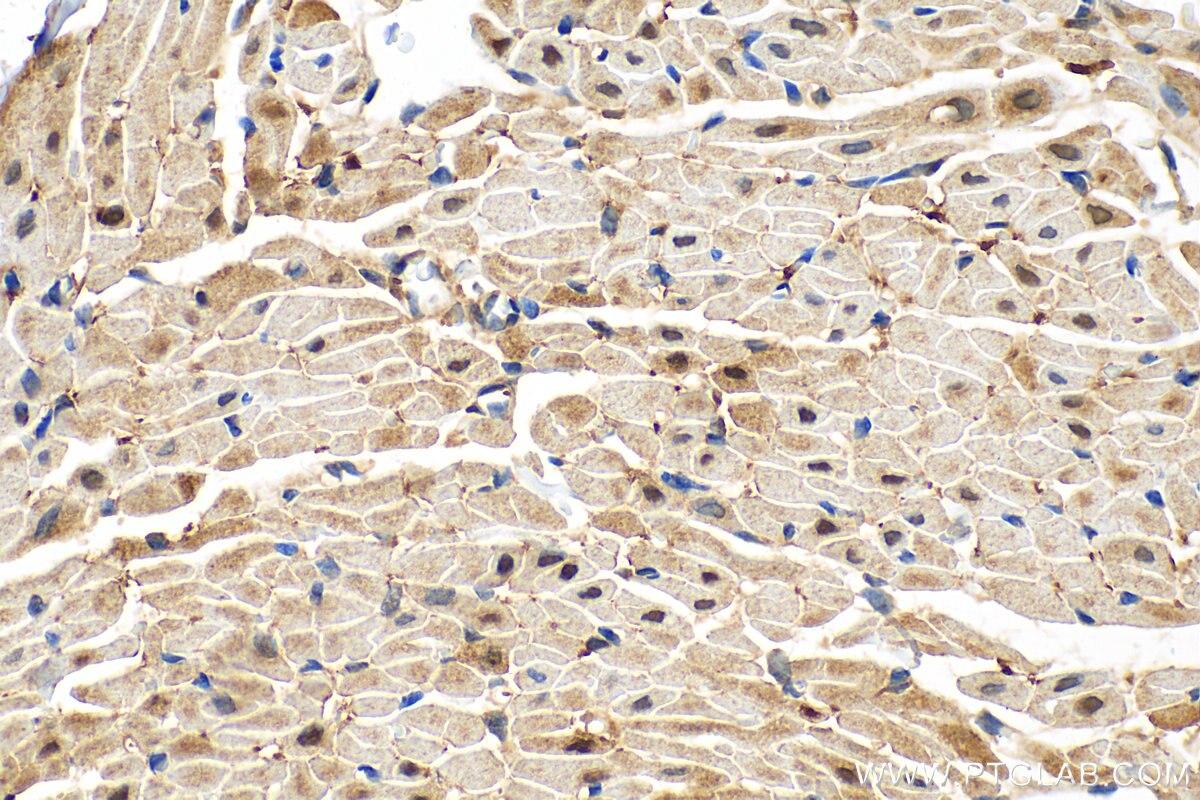 Immunohistochemistry (IHC) staining of rat heart tissue using SHP2 Recombinant antibody (82503-1-RR)