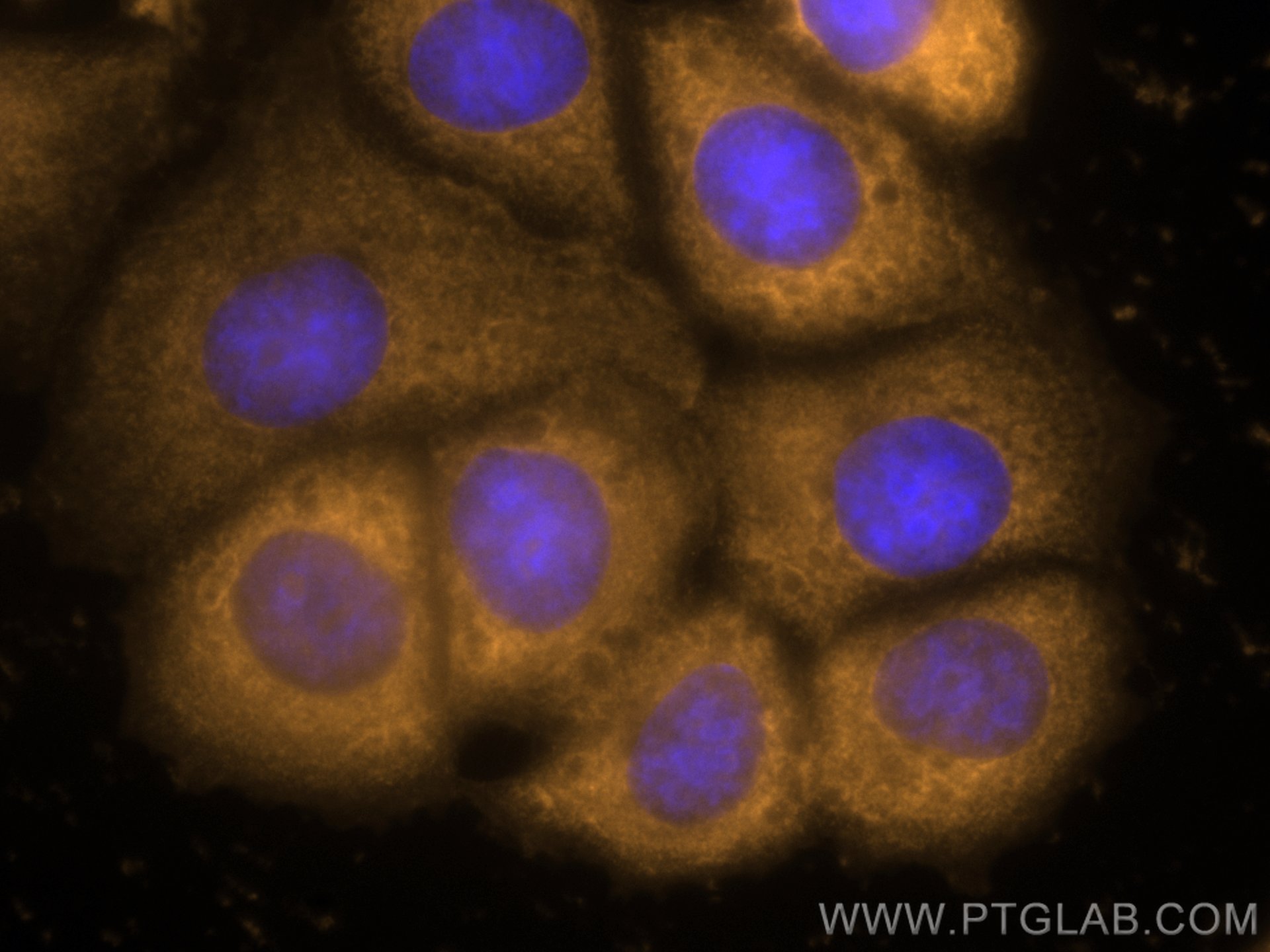 Immunofluorescence (IF) / fluorescent staining of MCF-7 cells using CoraLite®555-conjugated PTPN11/SHP2 Monoclonal ant (CL555-66795)