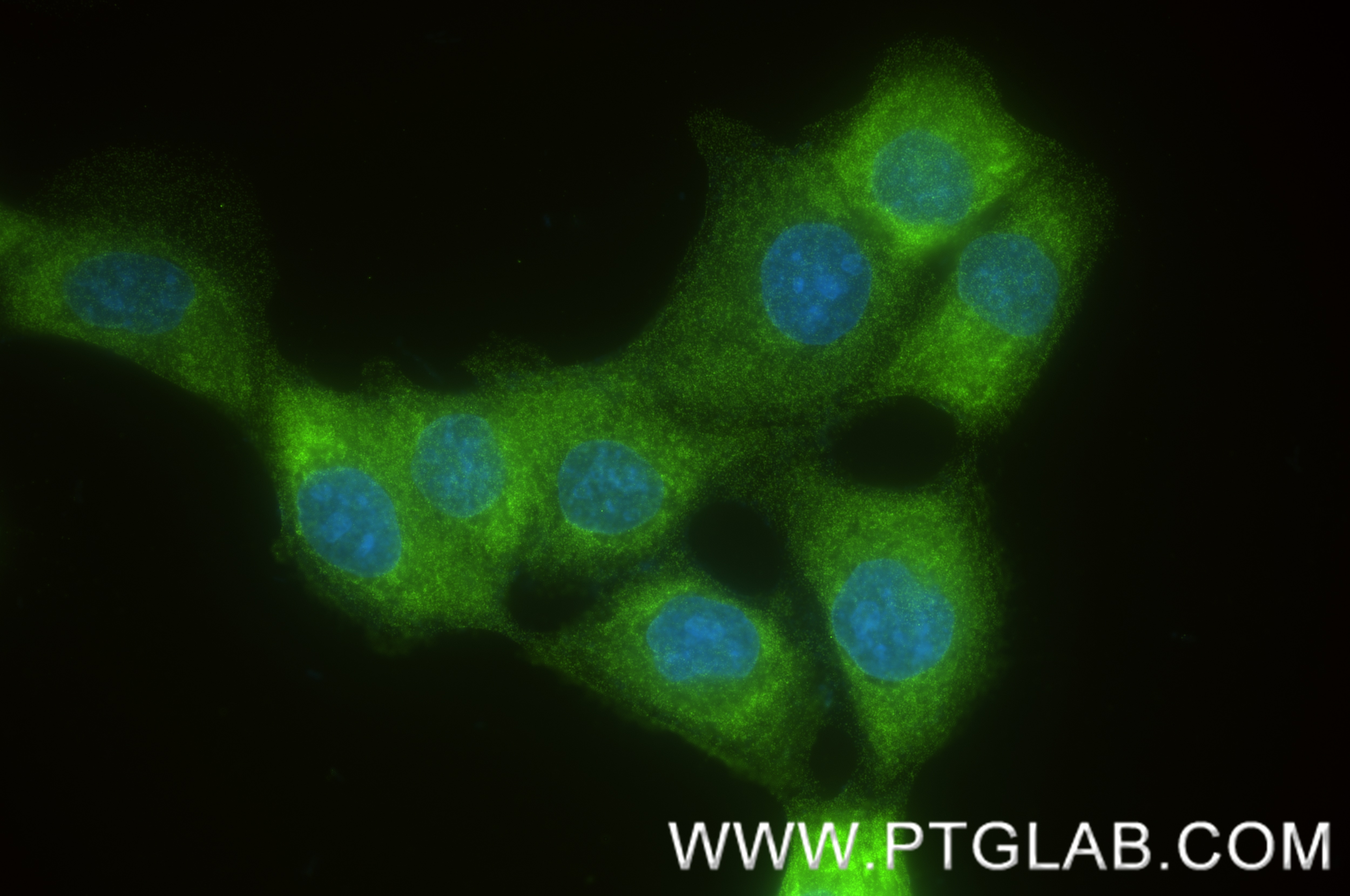 Immunofluorescence (IF) / fluorescent staining of A431 cells using PTPN12 Recombinant antibody (83851-6-RR)