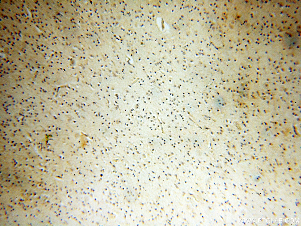 Immunohistochemistry (IHC) staining of human brain tissue using PTPN14 Polyclonal antibody (18053-1-AP)