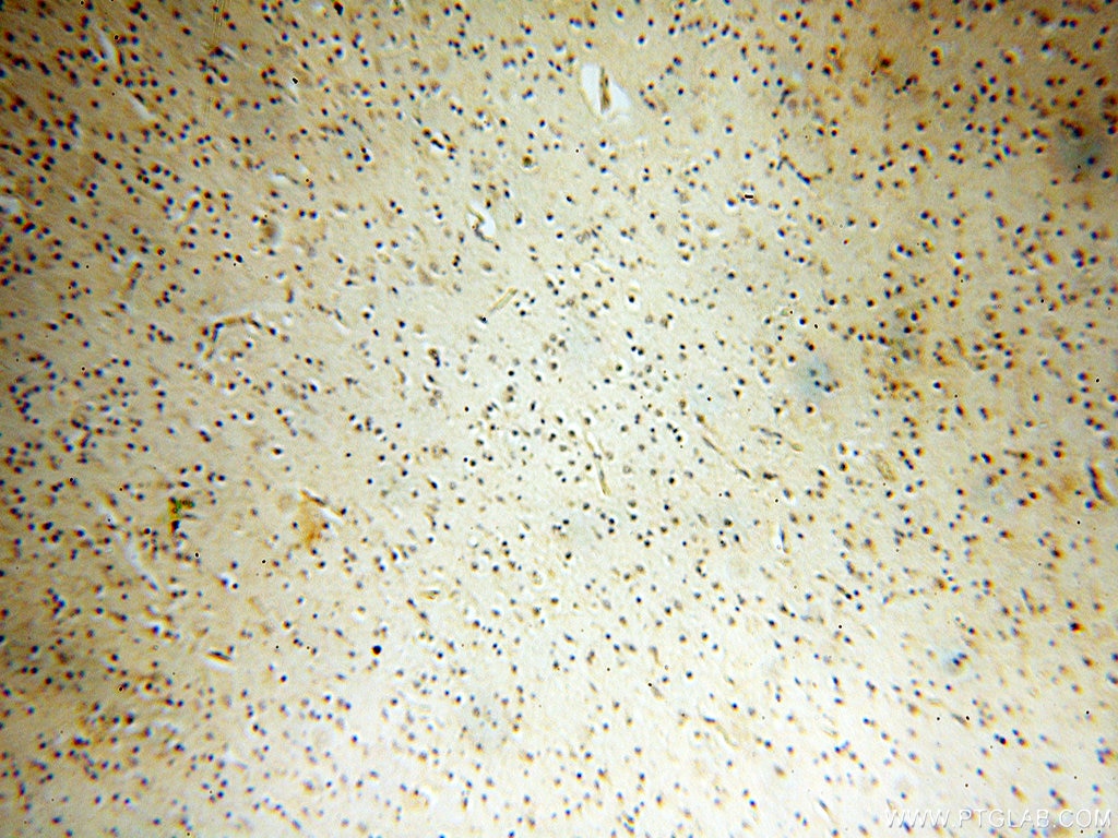 IHC staining of human brain using 18053-1-AP