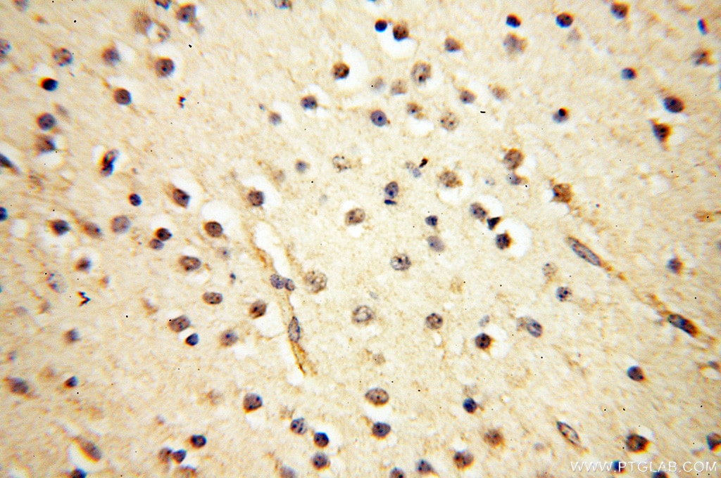 IHC staining of human brain using 18053-1-AP