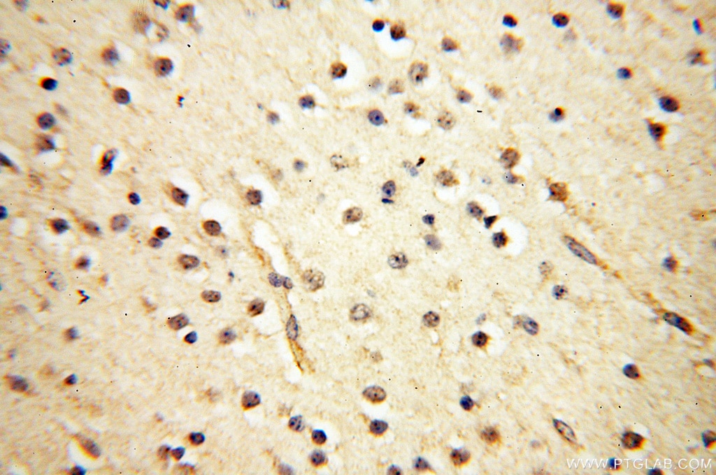 Immunohistochemistry (IHC) staining of human brain tissue using PTPN14 Polyclonal antibody (18053-1-AP)