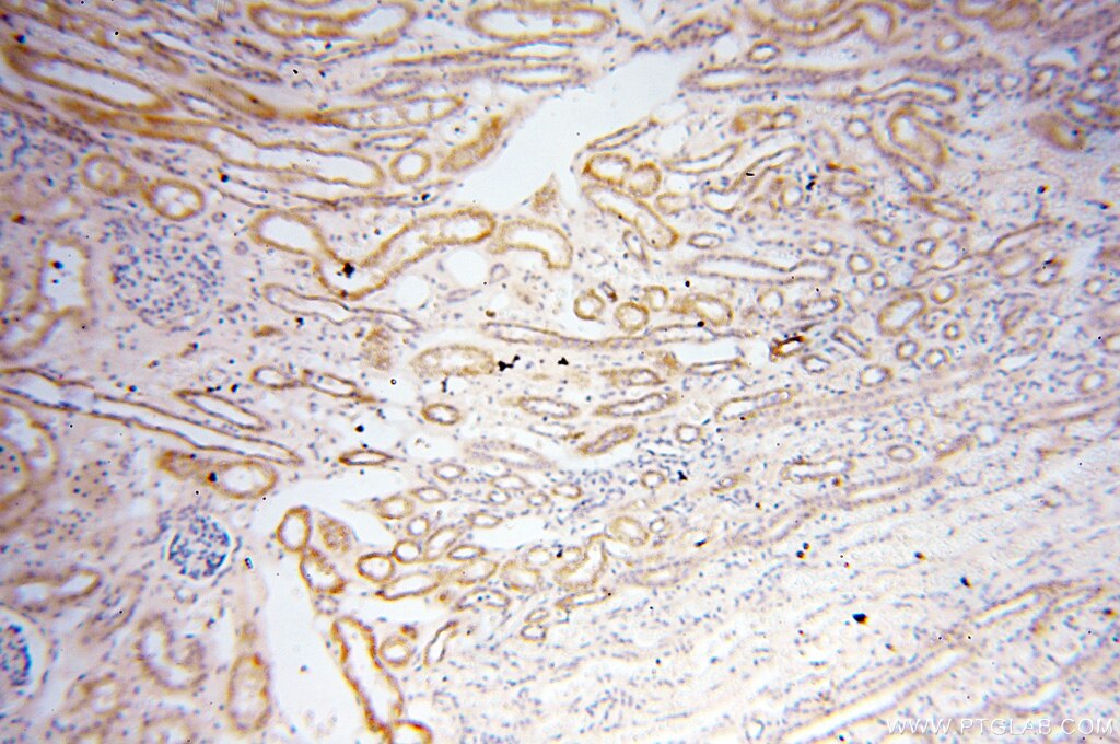 Immunohistochemistry (IHC) staining of human kidney tissue using PTPN14 Polyclonal antibody (18053-1-AP)