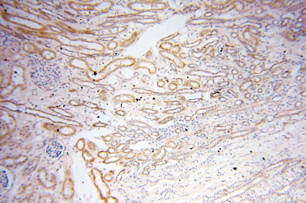 IHC staining of human kidney using 18053-1-AP