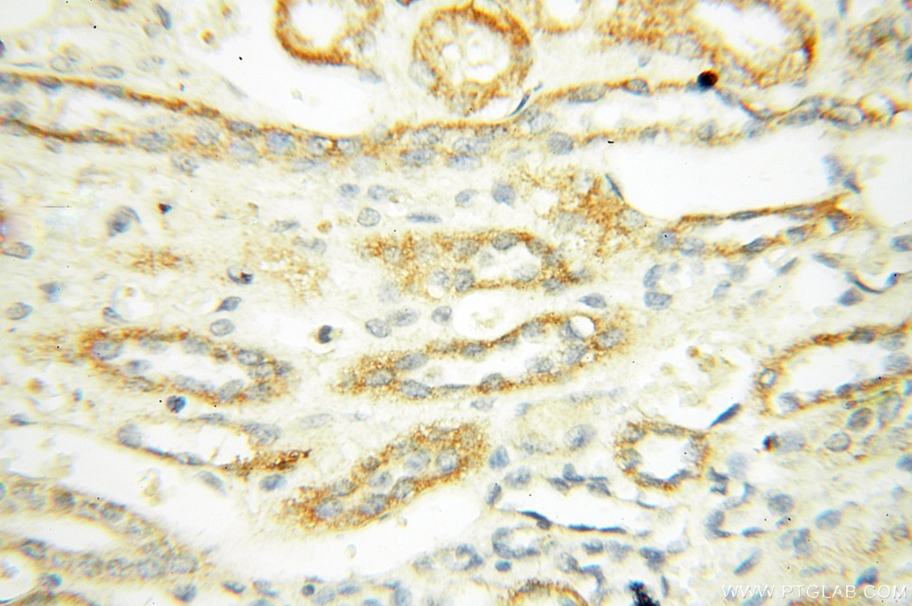 Immunohistochemistry (IHC) staining of human kidney tissue using PTPN14 Polyclonal antibody (18053-1-AP)