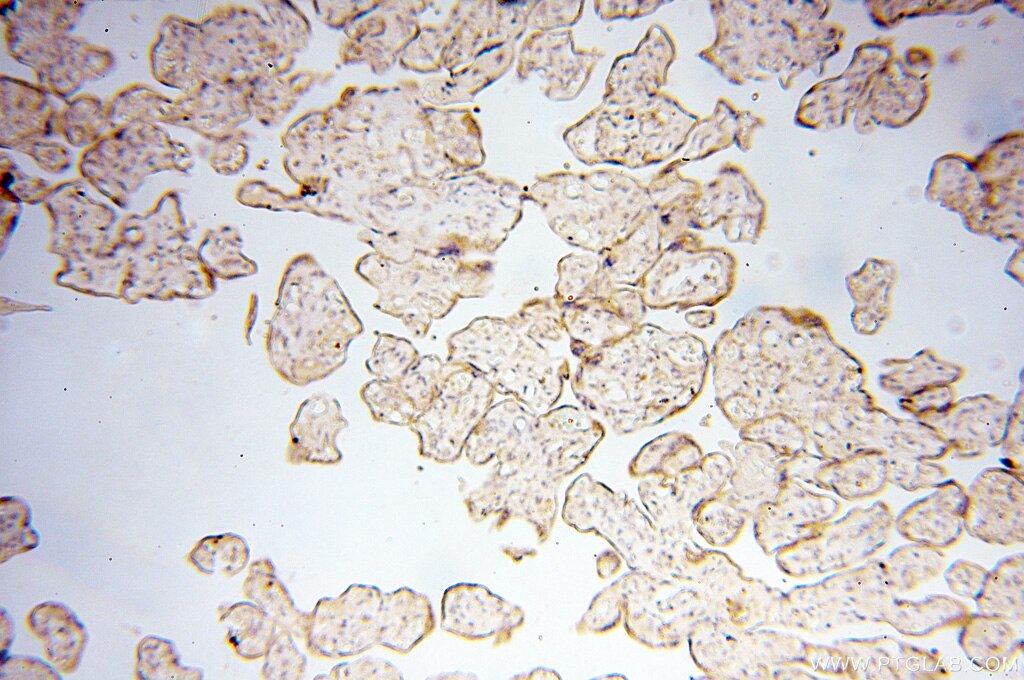 Immunohistochemistry (IHC) staining of human placenta tissue using PTPN14 Polyclonal antibody (18053-1-AP)