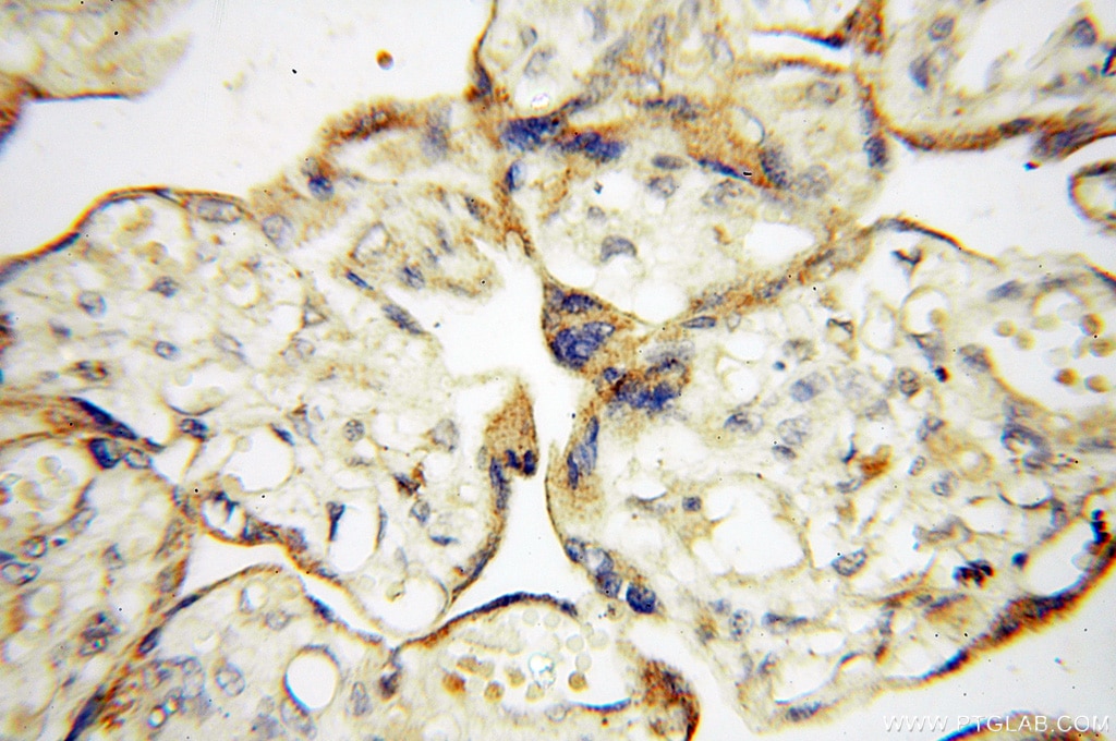 Immunohistochemistry (IHC) staining of human placenta tissue using PTPN14 Polyclonal antibody (18053-1-AP)