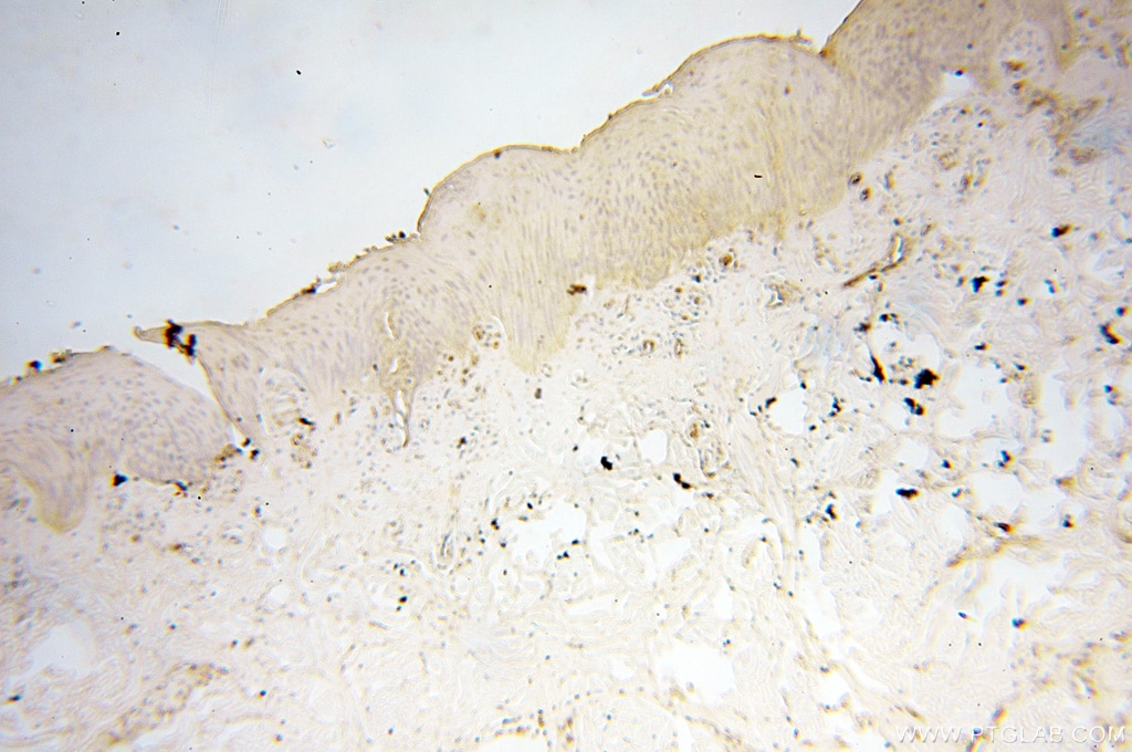 Immunohistochemistry (IHC) staining of human skin tissue using PTPN14 Polyclonal antibody (18053-1-AP)