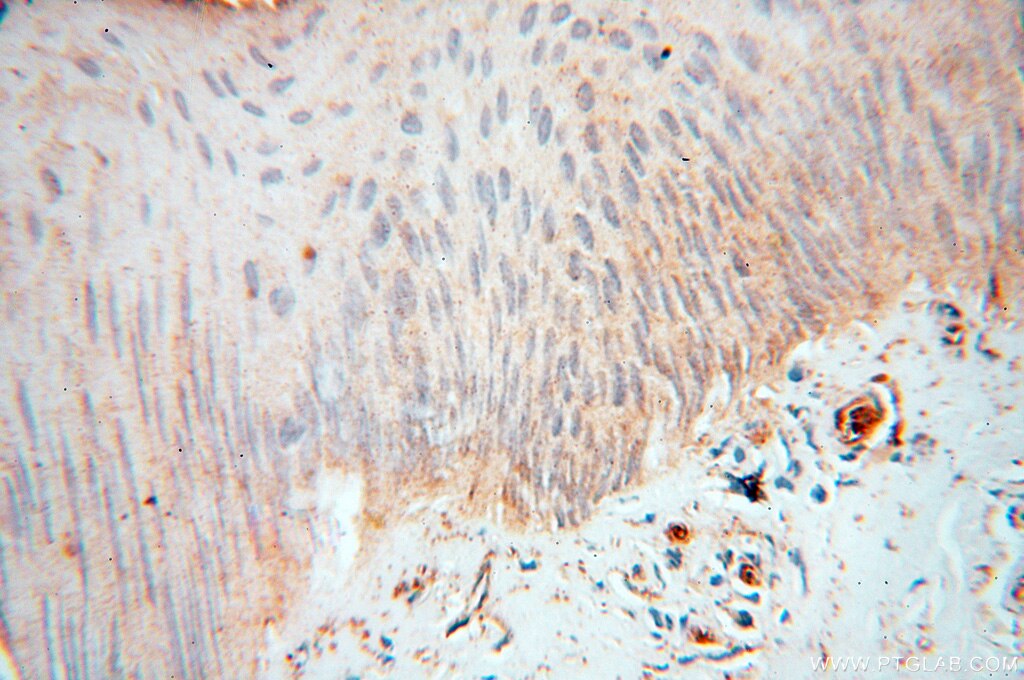Immunohistochemistry (IHC) staining of human skin tissue using PTPN14 Polyclonal antibody (18053-1-AP)