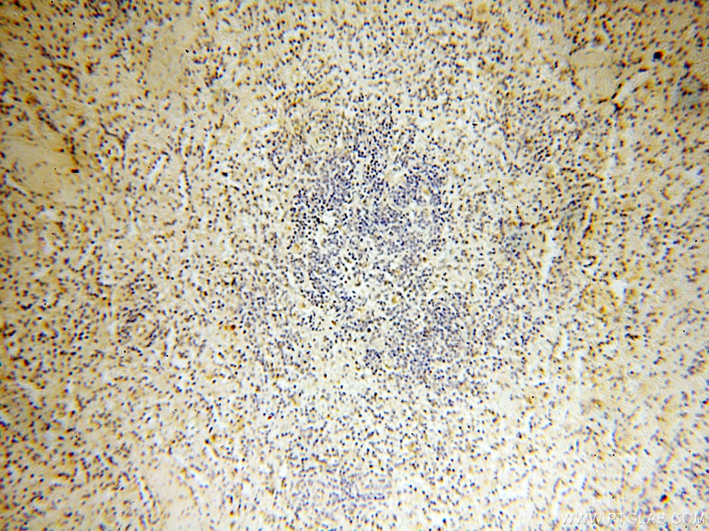 Immunohistochemistry (IHC) staining of human spleen tissue using PTPN14 Polyclonal antibody (18053-1-AP)