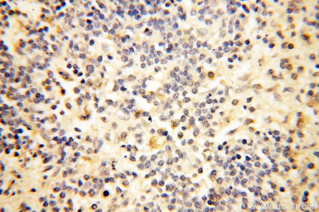 Immunohistochemistry (IHC) staining of human spleen tissue using PTPN14 Polyclonal antibody (18053-1-AP)