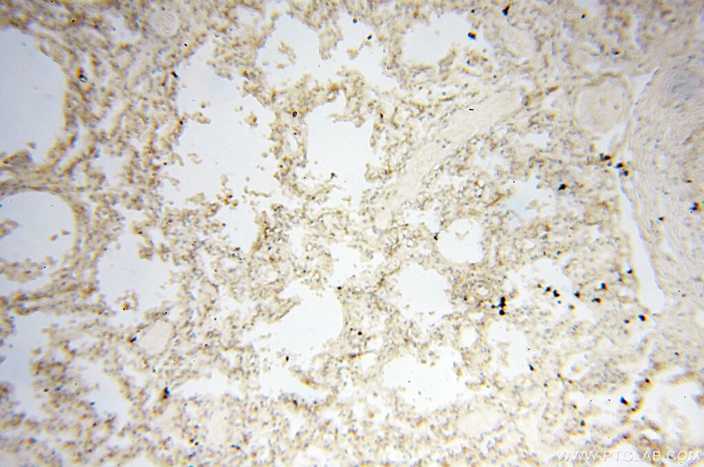 Immunohistochemistry (IHC) staining of human lung tissue using PTPN14 Polyclonal antibody (18053-1-AP)