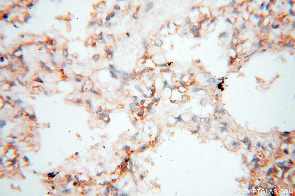IHC staining of human lung using 18053-1-AP
