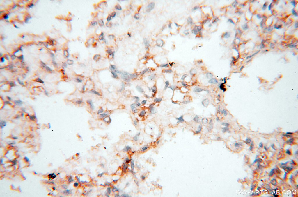 Immunohistochemistry (IHC) staining of human lung tissue using PTPN14 Polyclonal antibody (18053-1-AP)