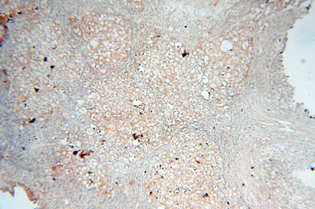 Immunohistochemistry (IHC) staining of human ovary tissue using PTPN14 Polyclonal antibody (18053-1-AP)